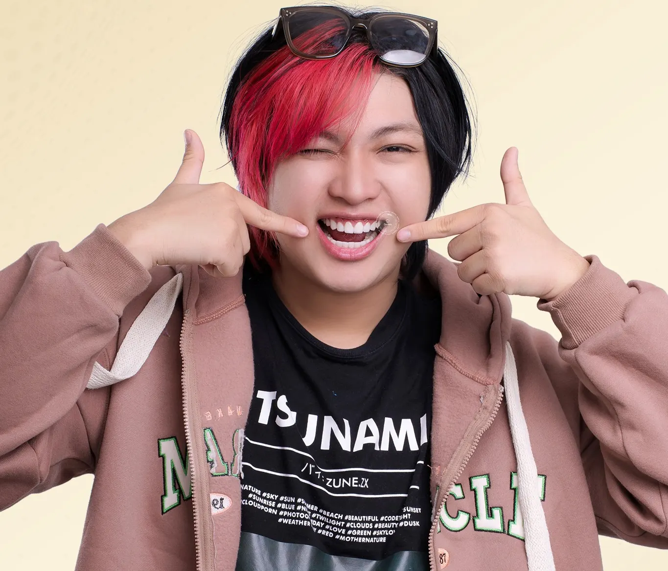 Dán răng sứ có cần mài răng không? Dán Veneer giá bao nhiêu tiền?